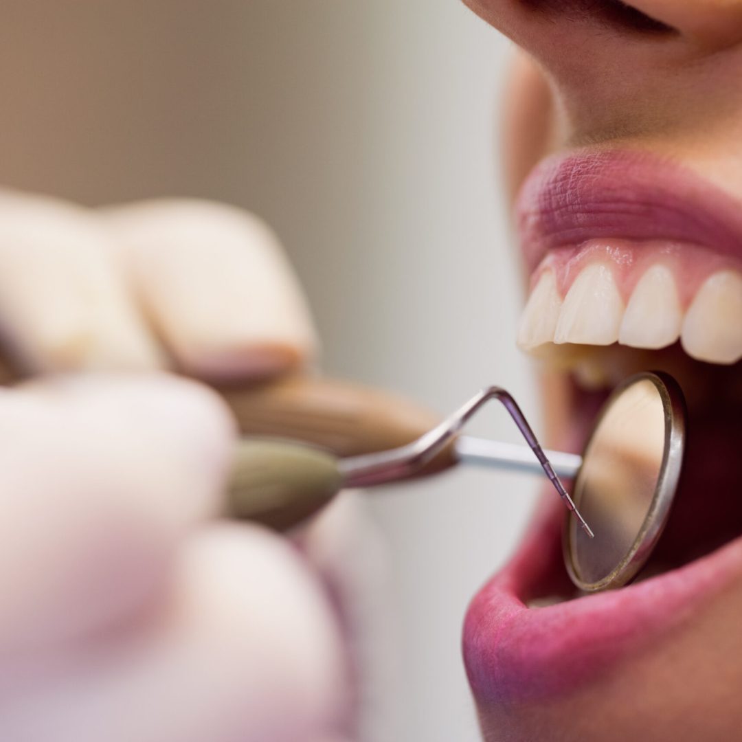 Close-up of dentist examining a female patient with tools at dental clinic